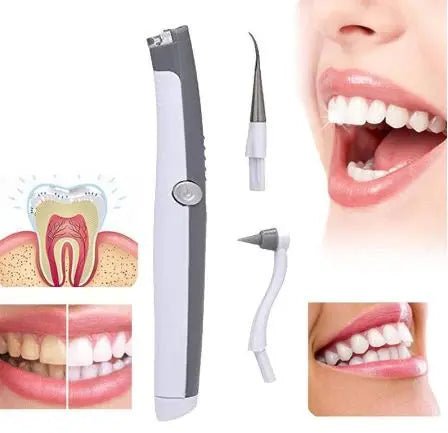 Sonic Pic Dental Cleaning System With Torch, Electric Calculus Teeth Cleaner Teeth Whitening *Free Shipping*